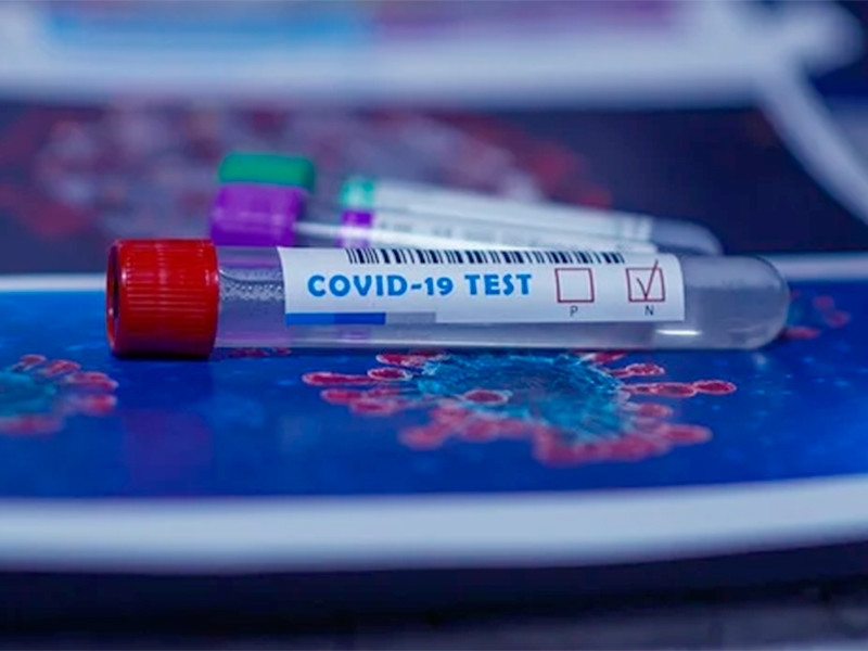 "Спасти Рождество": Австрия по примеру соседней Словакии готовит массовое тестирование на COVID-19