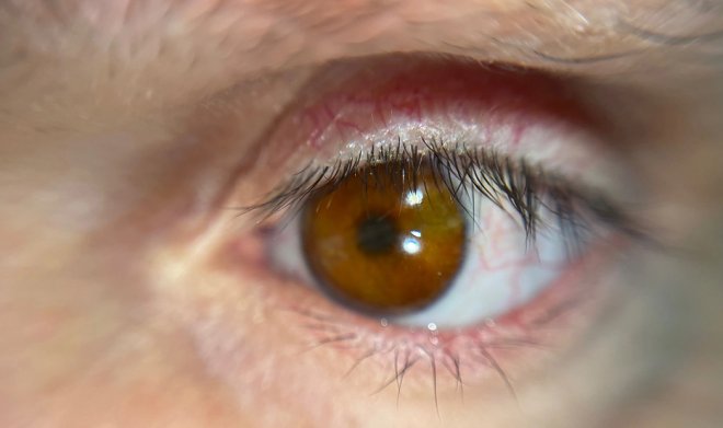 В Британии разработали технологию 3D-печати невероятно реалистичных глазных протезов